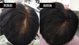 Nさん BeforeAfter