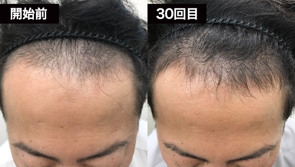 Tさん BeforeAfter