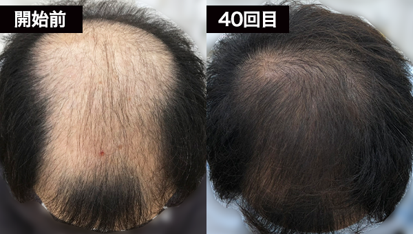 Gさん 開始前