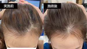 Wさん BeforeAfter