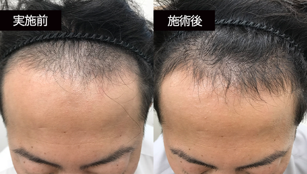 TYさん BeforeAfter