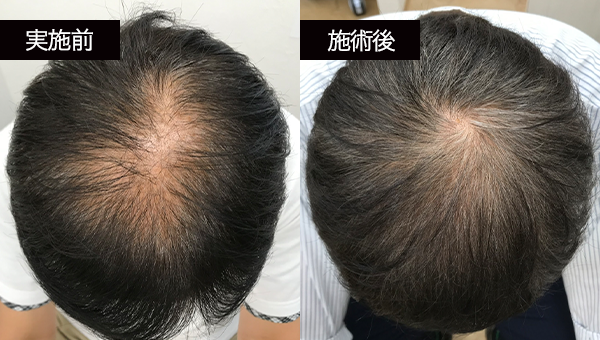 OHさん BeforeAfter
