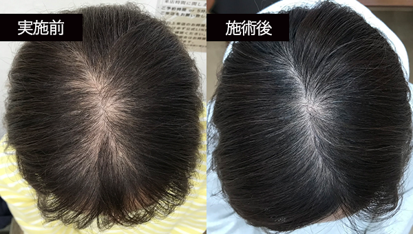 SMさん BeforeAfter