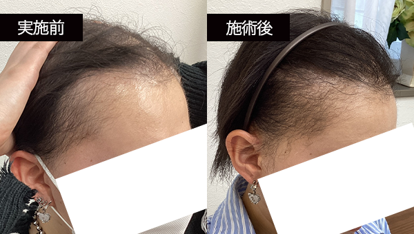 HAさん BeforeAfter