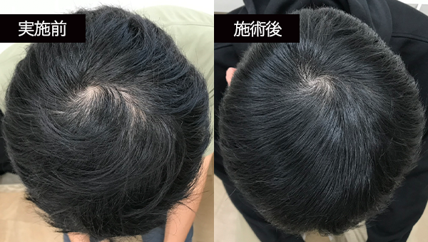 NNさん BeforeAfter